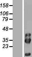 PIK3IP1 (NM_052880) Human Tagged ORF Clone