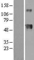 Hemopexin(HPX) (NM_000613) Human Tagged ORF Clone