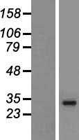 HLA-DRB5 (NM_002125) Human Tagged ORF Clone