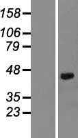 Decorin(DCN) (NM_001920) Human Tagged ORF Clone
