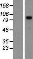 VCAM1 (NM_001078) Human Tagged ORF Clone