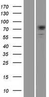 Dystrophia myotonica protein kinase(DMPK) (NM_004409) Human Tagged ORF Clone
