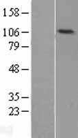DNA Ligase IV(LIG4) (NM_002312) Human Tagged ORF Clone