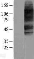 VPAC2(VIPR2) (NM_003382) Human Tagged ORF Clone