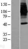 DMT1(SLC11A2) (NM_000617) Human Tagged ORF Clone