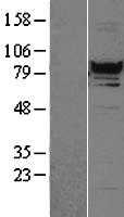 RFX3 (NM_134428) Human Tagged ORF Clone