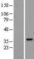 REA(PHB2) (NM_001144831) Human Tagged ORF Clone