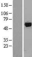 GRK1 (NM_002929) Human Tagged ORF Clone