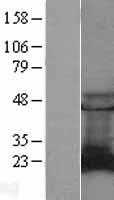 Rab9(RAB9A) (NM_004251) Human Tagged ORF Clone