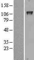 GTF2IRD1 (NM_016328) Human Tagged ORF Clone