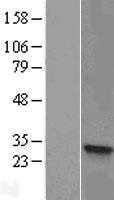 HSD17B8 (NM_014234) Human Tagged ORF Clone