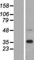 NRG1 (NM_013958) Human Tagged ORF Clone