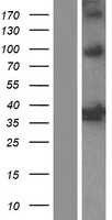 Heme oxygenase 2(HMOX2) (NM_001127204) Human Tagged ORF Clone