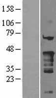 Nkx2.5(NKX2-5) (NM_004387) Human Tagged ORF Clone
