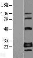 GADD45GIP1 (NM_052850) Human Tagged ORF Clone