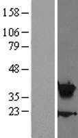 HOXA5 (NM_019102) Human Tagged ORF Clone