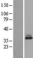 NACA (NM_005594) Human Tagged ORF Clone