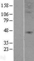 Glycine Receptor alpha 3(GLRA3) (NM_006529) Human Tagged ORF Clone
