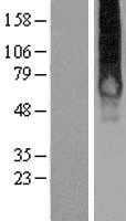 GALR1 (NM_001480) Human Tagged ORF Clone