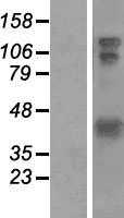HOMER1(HOMER1) (NM_004272) Human Tagged ORF Clone