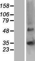 GJB5 (NM_005268) Human Tagged ORF Clone