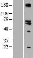 GLS2 (NM_013267) Human Tagged ORF Clone