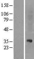 Nociceptin receptor(OPRL1) (NM_000913) Human Tagged ORF Clone