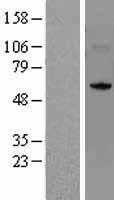 NSUN5 (NM_148956) Human Tagged ORF Clone