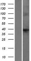 HAP40(F8A1) (NM_012151) Human Tagged ORF Clone