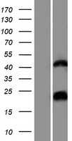 HCG1657980(LOC200726) (NM_001102659) Human Tagged ORF Clone
