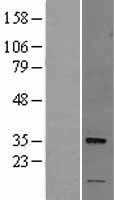 Nogo B receptor(NUS1) (NM_138459) Human Tagged ORF Clone