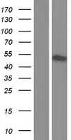 NFS1 (NM_001198989) Human Tagged ORF Clone