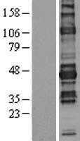 NFAT2(NFATC1) (NM_172388) Human Tagged ORF Clone