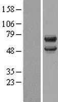DCDC2 (NM_016356) Human Tagged ORF Clone