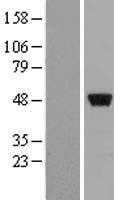 ZNF385(ZNF385A) (NM_015481) Human Tagged ORF Clone