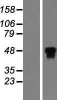 HNF 4 alpha(HNF4A) (NM_001030003) Human Tagged ORF Clone