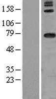 DARS2 (NM_018122) Human Tagged ORF Clone
