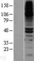 DPEP1 (NM_001128141) Human Tagged ORF Clone