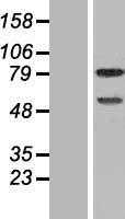 DEF6 (NM_022047) Human Tagged ORF Clone