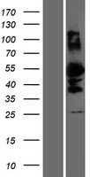 DMRTA1 (NM_022160) Human Tagged ORF Clone