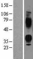 Vasopressin V1b receptor(AVPR1B) (NM_000707) Human Tagged ORF Clone
