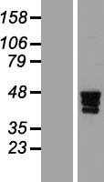 ZNF362 (NM_152493) Human Tagged ORF Clone