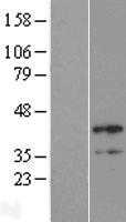 B4GALT4 (NM_212543) Human Tagged ORF Clone