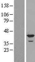 DMC1 (NM_007068) Human Tagged ORF Clone
