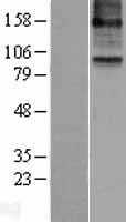 15 Lipoxygenase 2(ALOX15B) (NM_001141) Human Tagged ORF Clone