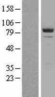 beta Catenin(CTNNB1) (NM_001098210) Human Tagged ORF Clone