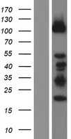 DZIP1 (NM_198968) Human Tagged ORF Clone