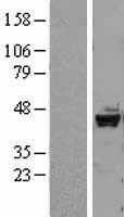 DRAK2(STK17B) (NM_004226) Human Tagged ORF Clone