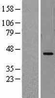 DHODH (NM_001361) Human Tagged ORF Clone