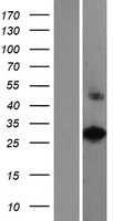 VAX2 (NM_012476) Human Tagged ORF Clone